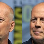 what-disease-does-bruce-willis-have